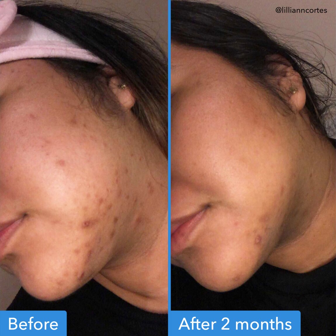 discoloration-correcting-serum-y2 zb_p.jpg