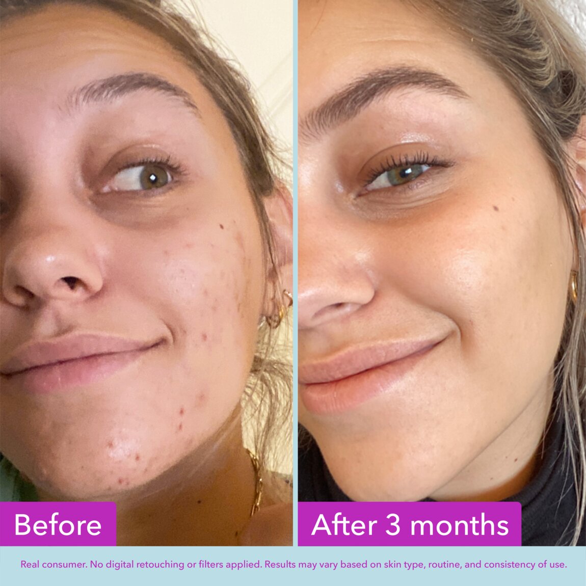 niacinamide-brightening-toner-g6 zb_p.jpg